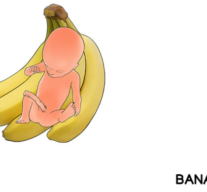 Semana 20 Banana