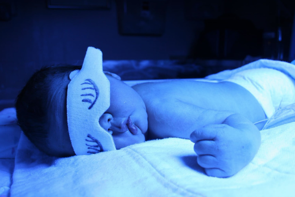 O que é icterícia neonatal?
